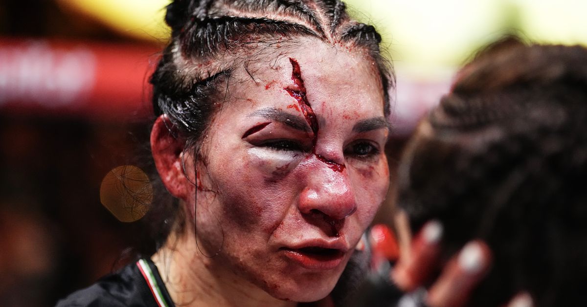 Irene Aldana offers update after stitches removed from horrific UFC 306 cut