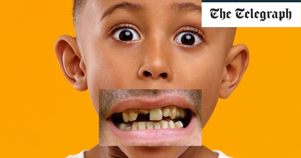 Why British children could soon be wearing dentures