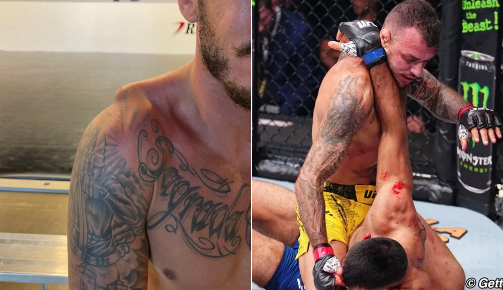 Renato Moicano fought at UFC Paris with gross shoulder injury