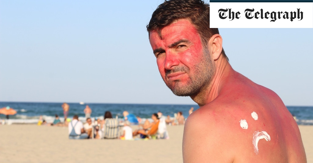 Why don’t Britons take skin cancer seriously?