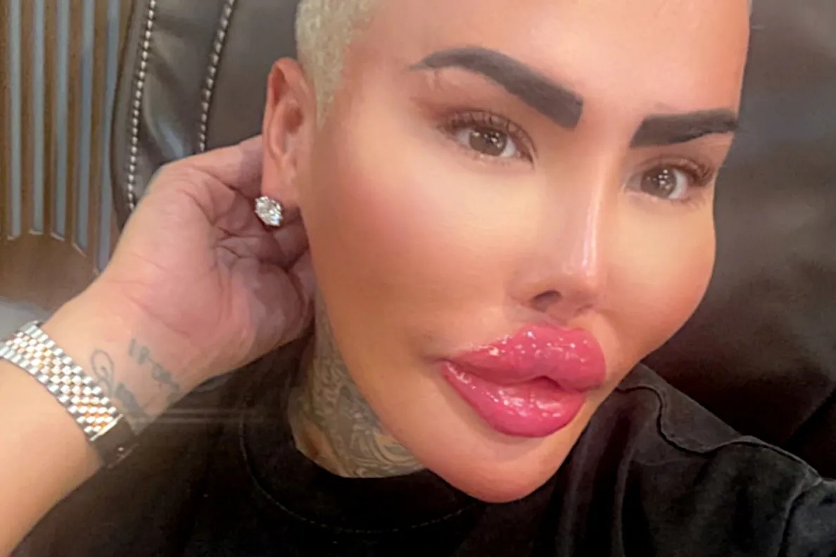 Kim Kardashian-obsessed TV star who calls himself ‘The Lip King’ arrested over death of BBL mum-of-five – The Sun