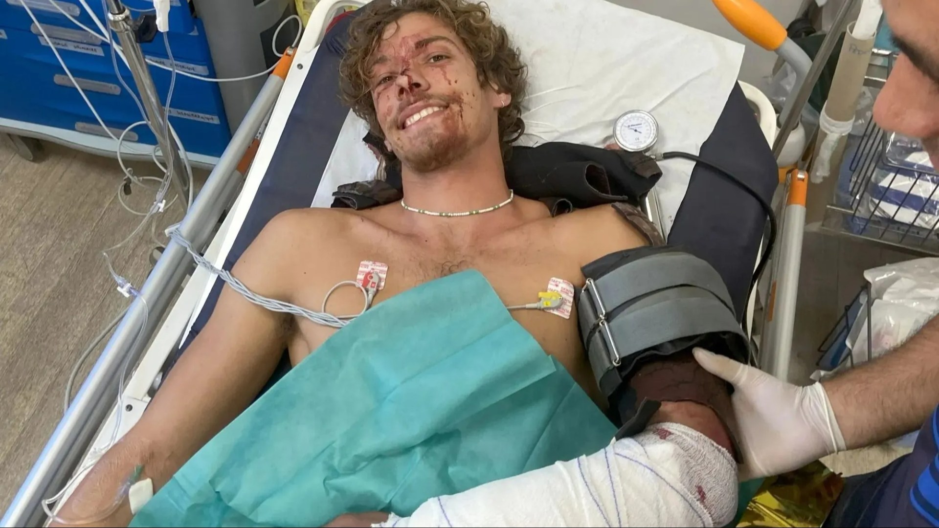 Diver, 20, left with shark's TEETH wedged in arm after savage attack as horror pics show aftermath