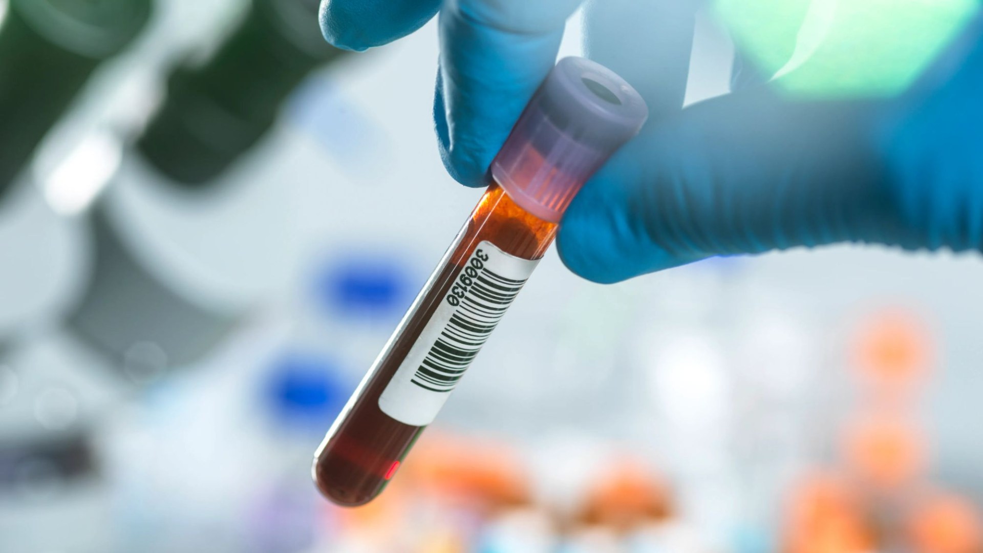 Breakthrough blood test could detect early stages of Alzheimer's YEARS before symptoms show