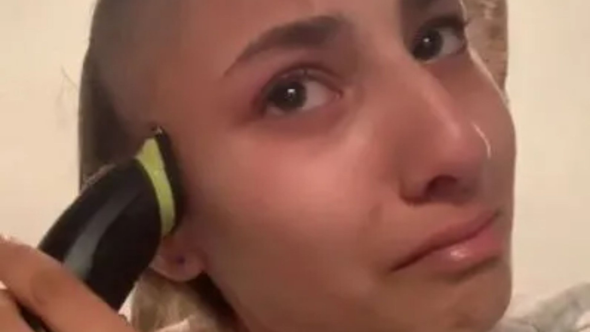 Tearful moment girl, 16, pulls out clumps of hair to share devastating reality of cancer after mistaking it for bug bite