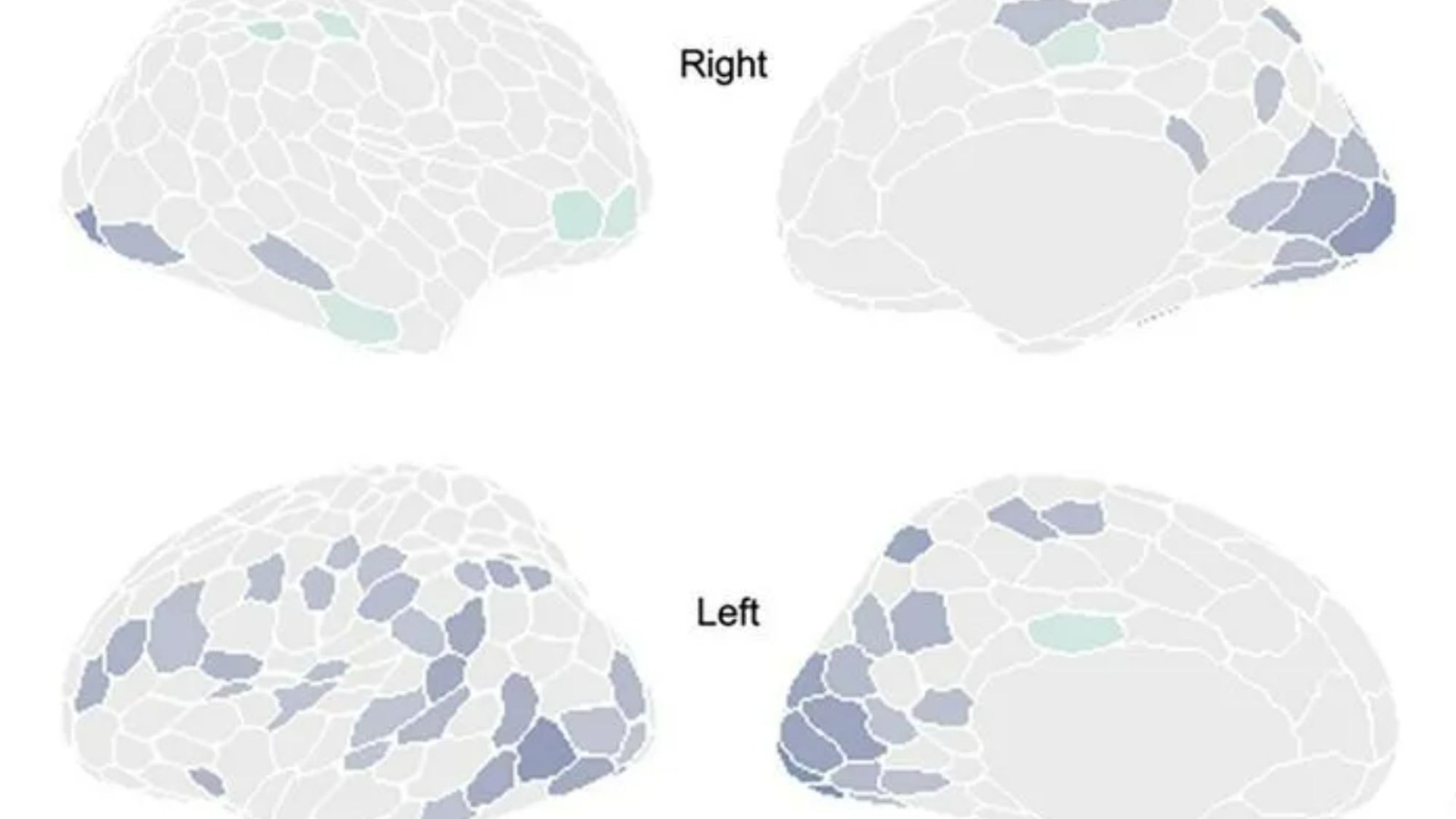 Men's brains SHRINK by 8pm everyday - before resetting overnight, scientists discover