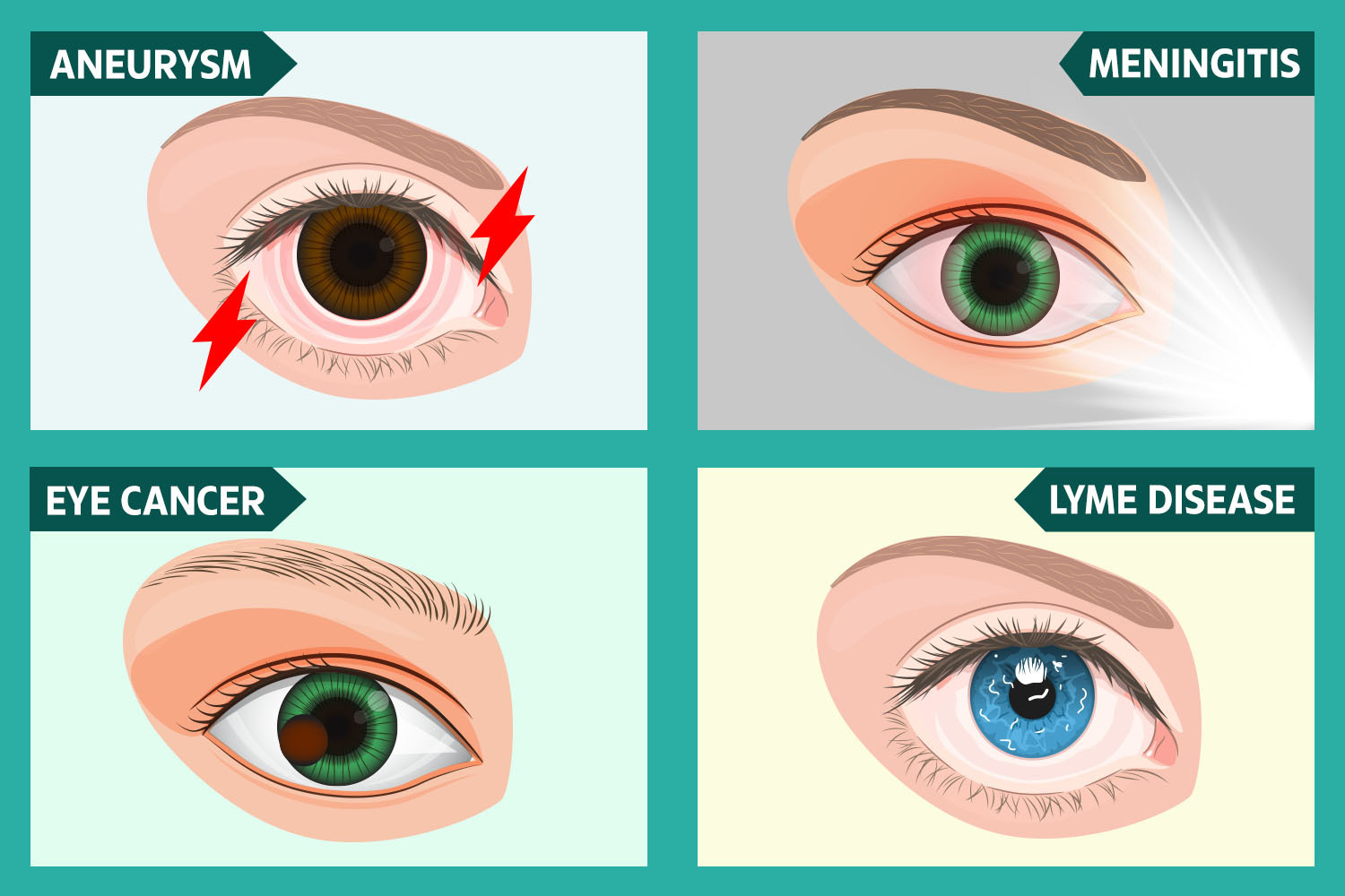 The 9 things your EYES can reveal about your health - from killer aneurysms to cancer and stroke