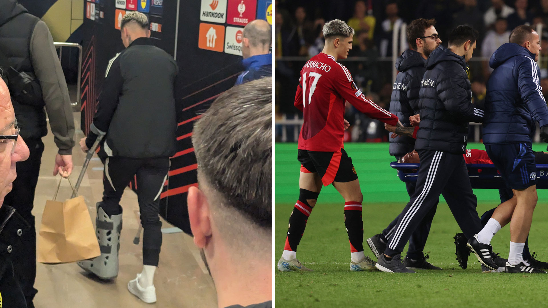 Antony leaves Fenerbahce stadium on crutches after Man Utd star carried off on stretcher in Europa League clash