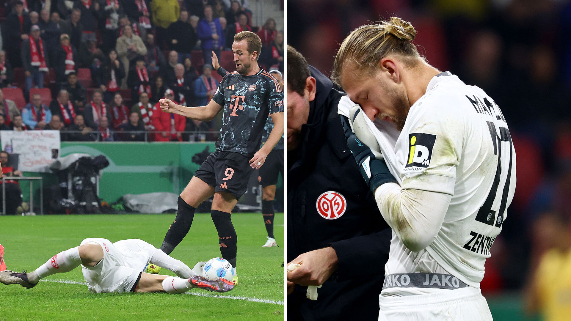 Goalkeeper 'blames' Harry Kane for leaving him bloodied with studs to the face during Bayern Munich clash