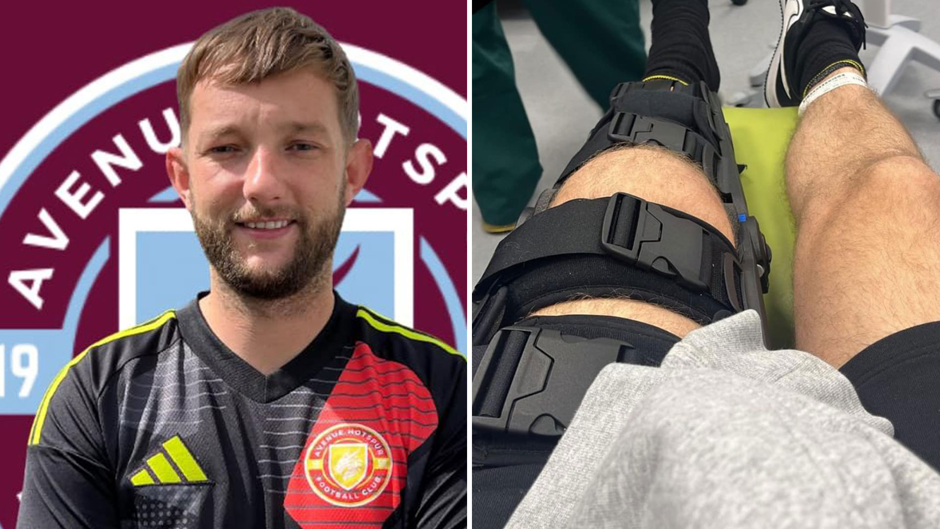 Football team beaten by baseball bat-wielding thugs and player has kneecap smashed in 'violent and distressing attack'