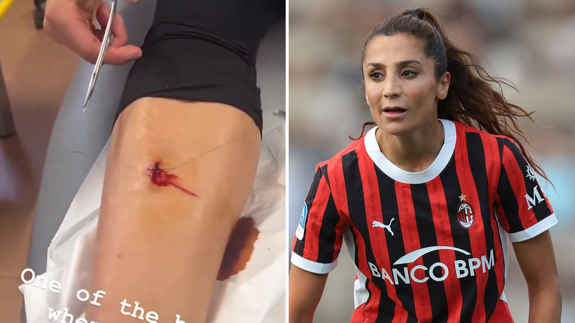 Watch AC Milan star stitch up her OWN gory wound in incredible video thanks to side hustle as a DOCTOR