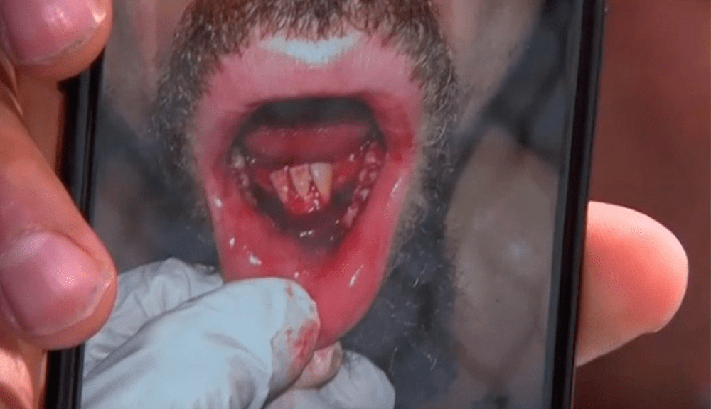 Robert Whittaker’s jaw mangled from Khamzat Chimaev