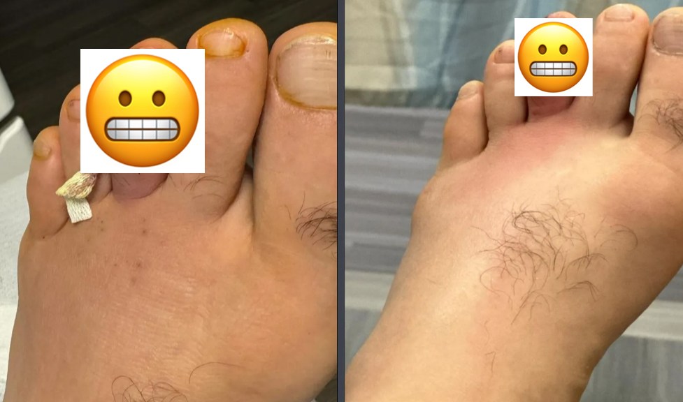 Belal Muhammad shares graphic photos of foot infection