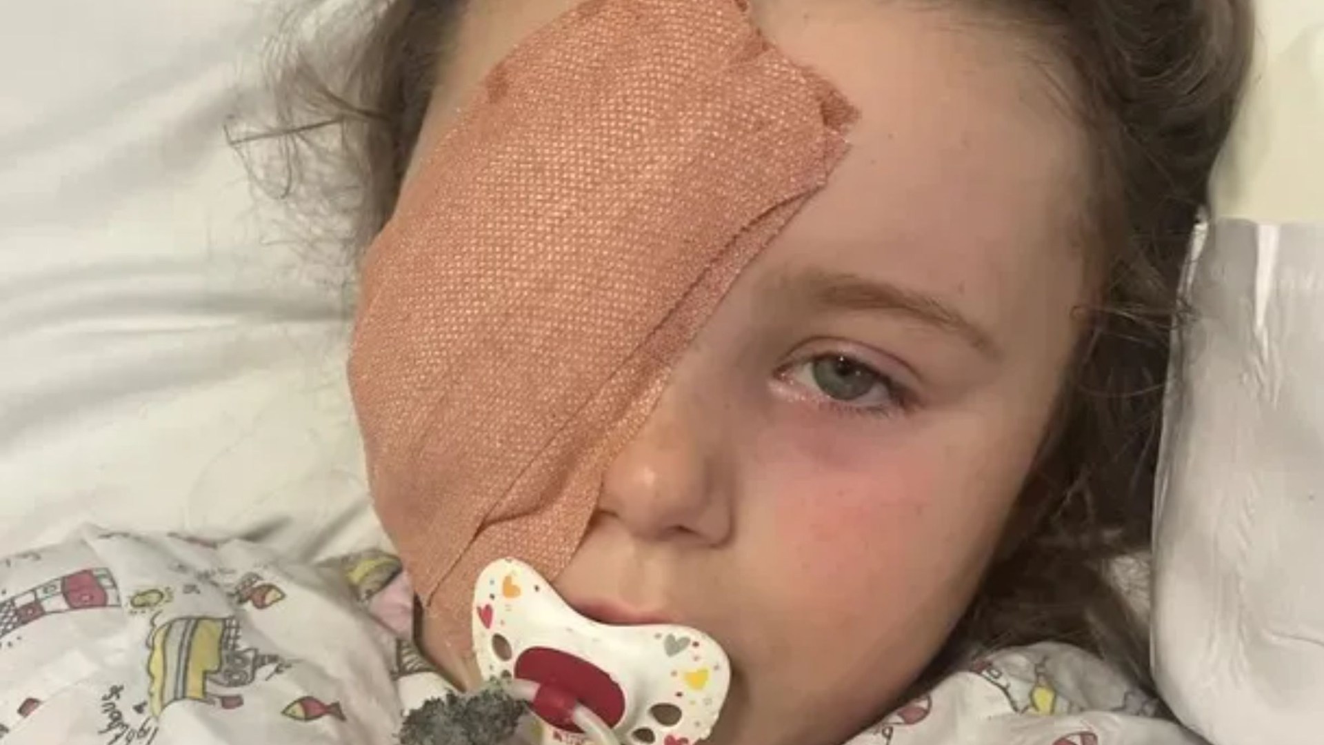 I'm sharing pics of my daughter, 7, who lost her eye after vape EXPLODED - split-second decision changed everything