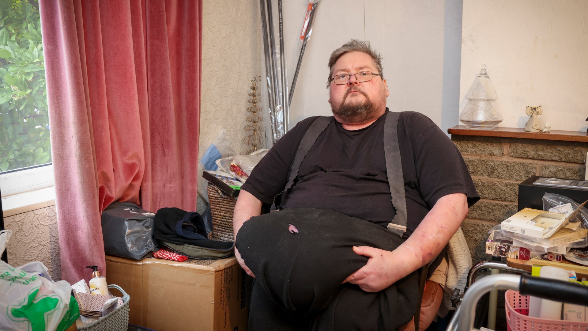 I've got a huge FIVE-STONE growth hanging off my stomach but doctors refuse to remove it - my life is hell