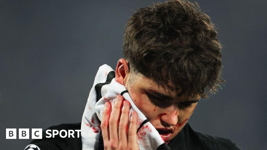 Barcelona defender Pau Cubarsi 'fine' after needing 10 stitches following kick to face