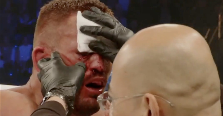 Video: BKFC bout stopped after fighter suffers disgusting facial rearrangement