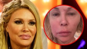 Brandi Glanville Admits She Hasn't Had Sex In Over A Year Because of Face Issue