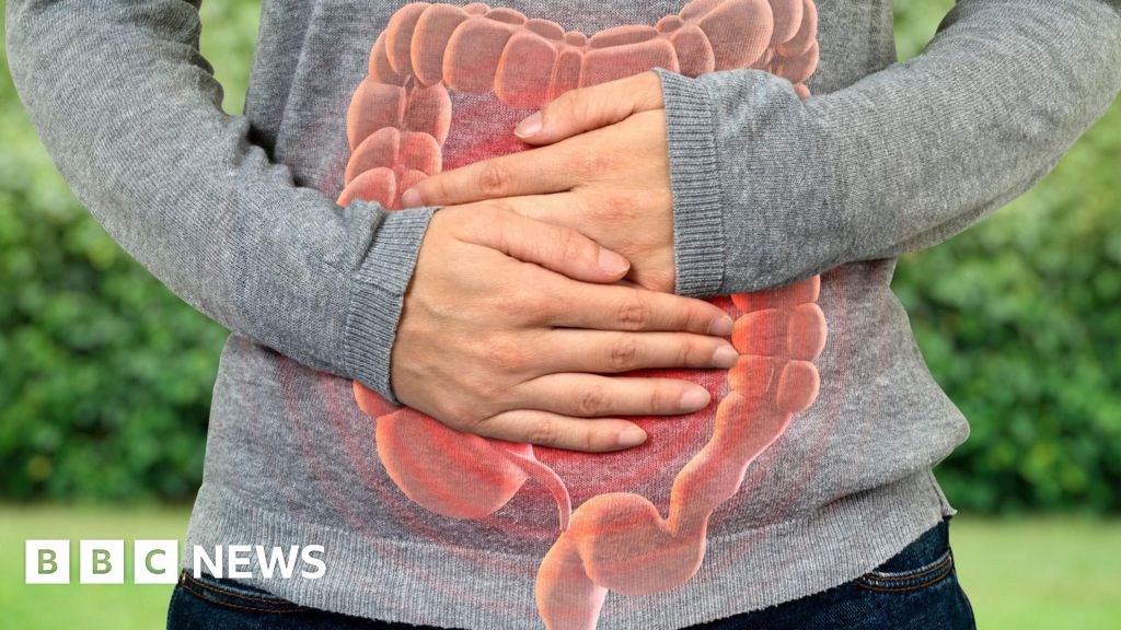 Bowel-cancer rates rising among younger people