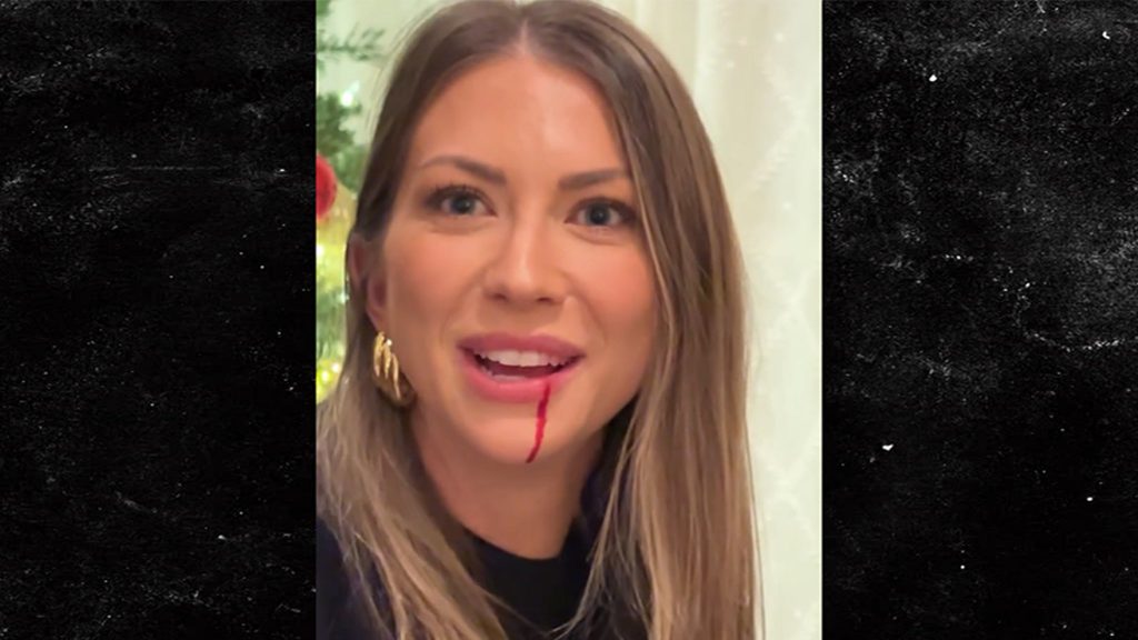 Stassi Schroeder Left Dripping Blood After a ‘Wicked’ Hit to the Face