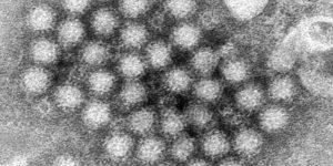 Norovirus cases are surging around the US and 40% above highs for this time of year