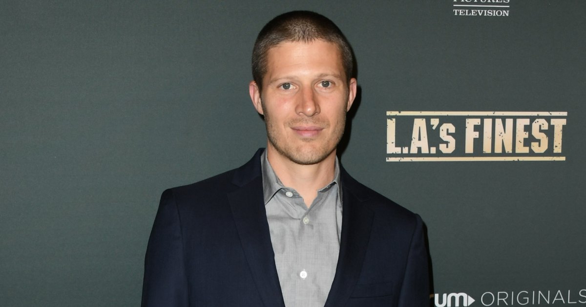 Zach Gilford Shares Shocking Photos of Face After Health Scare