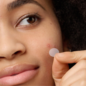 Do Pimple Patches Really Work? Let’s Find Out