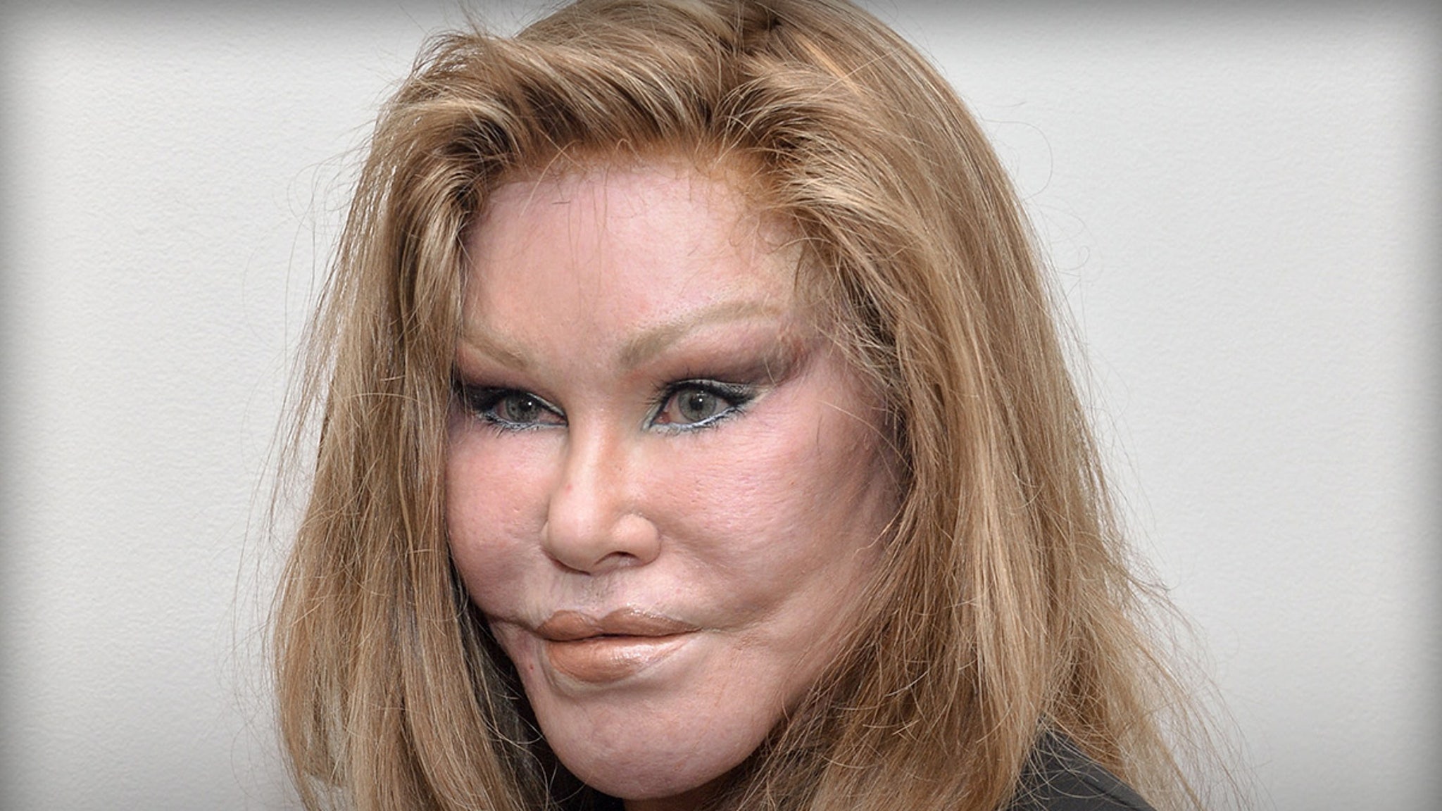 'Catwoman' Jocelyn Wildenstein Dead At 84