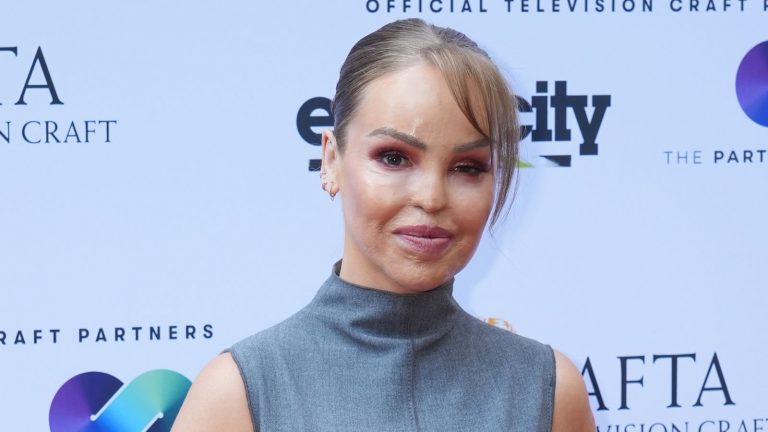 Katie Piper reveals artificial eye decision – 16 years after acid attack | Ents & Arts News