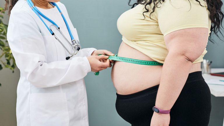 People being ‘overdiagnosed’ with obesity because BMI score not ‘nuanced’ enough, medics say | Science, Climate & Tech News