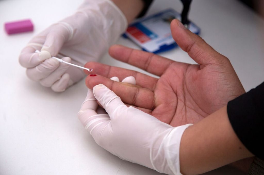 HIV Budget Cuts Would Spark Case Surge, Democrats Warn Trump