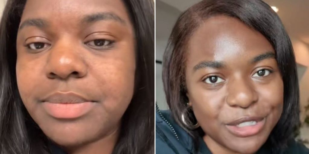 ‘Ozempic made me look 10 years younger