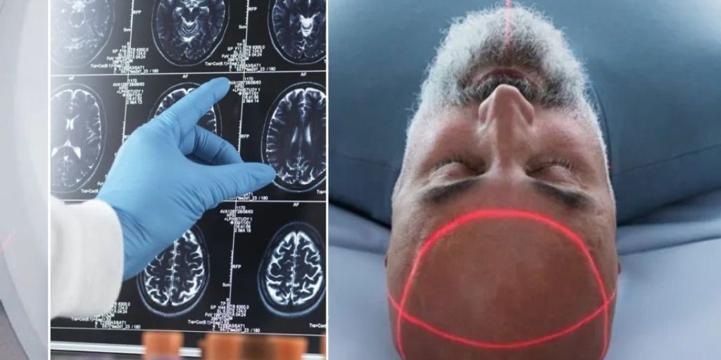 Dementia warning as condition that affects 1.5 million Britons may triple risk of brain decline from 45
