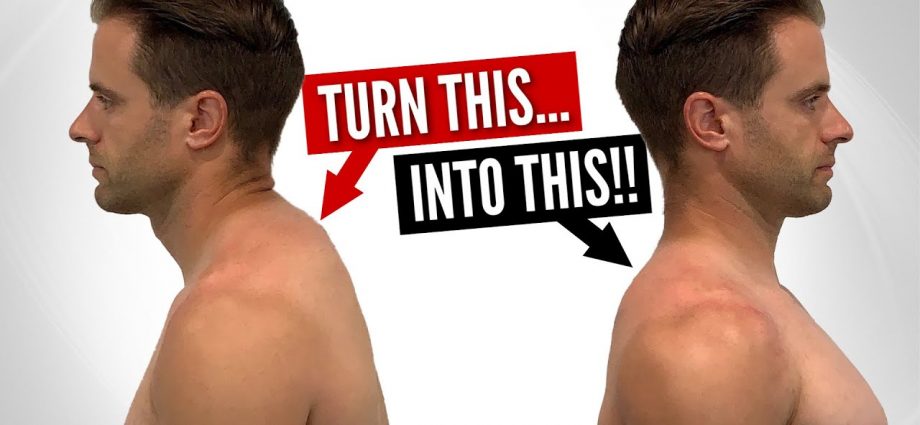 Fix Neck Hump FAST With These Home Exercises!