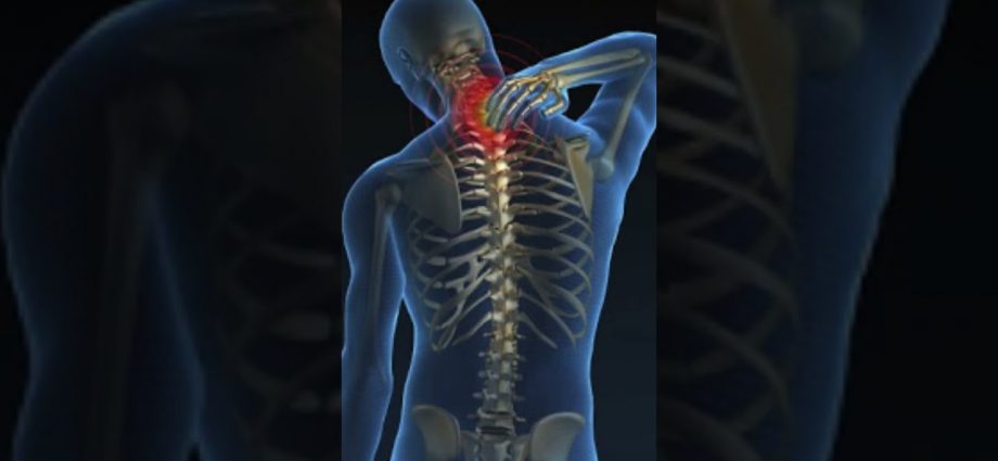 PERSISTENT RHOMBOID PAIN.  BEST Exercises & Stretches