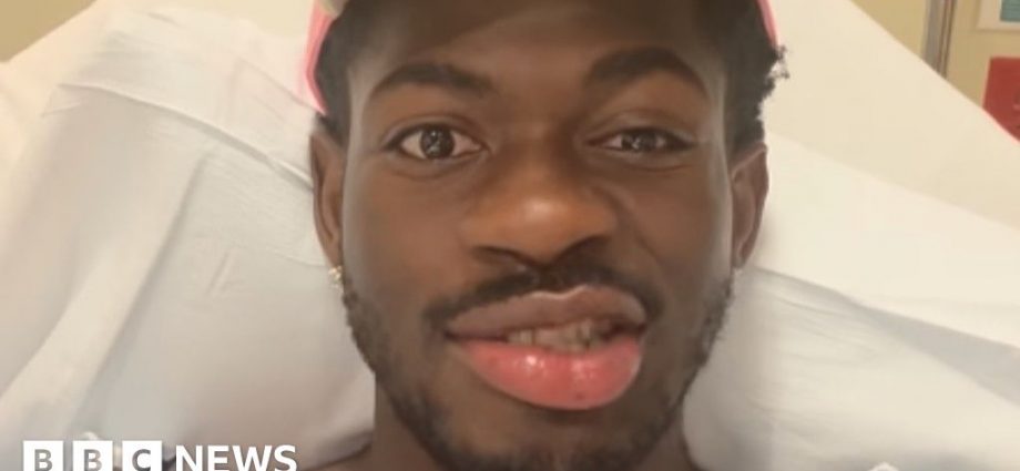 Lil Nas X in hospital with partial face paralysis