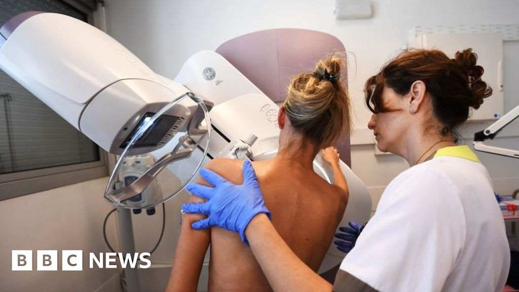Male workers should be able to carry out mammograms, experts say