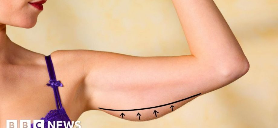 UK cosmetic surgery trends: body contouring and anti-wrinkles