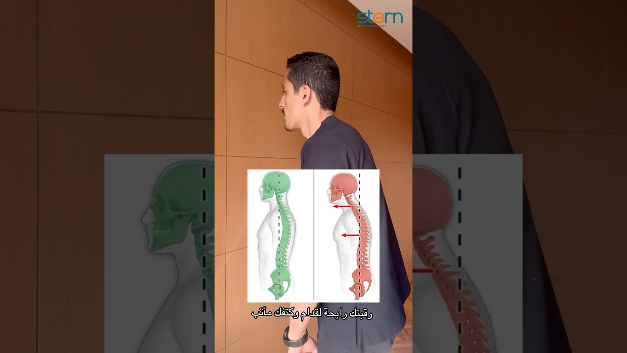 تمرين علاج تحدب الرقبة!