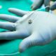 A Neuralink Rival Just Tested a Brain Implant in a Person