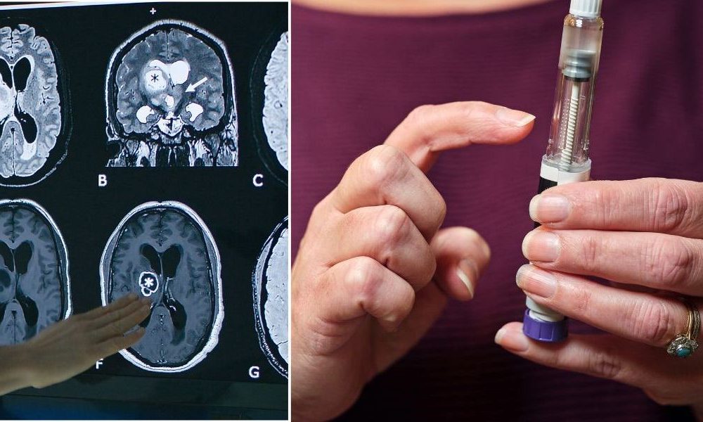 Cancer concerns spark fresh warning over weight loss injections