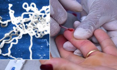 Syphilis rates soar in England as experts sound alarm