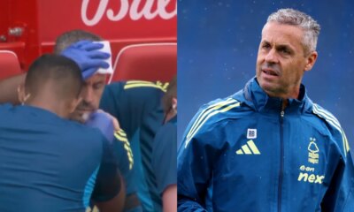 Nottingham Forest coach requires stitches after overenthusiastic goal celebration