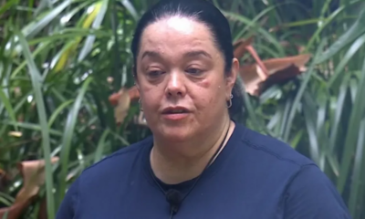 I'm A Celebrity's Lisa Riley sparks concern as ITV viewers ask 'what's wrong'