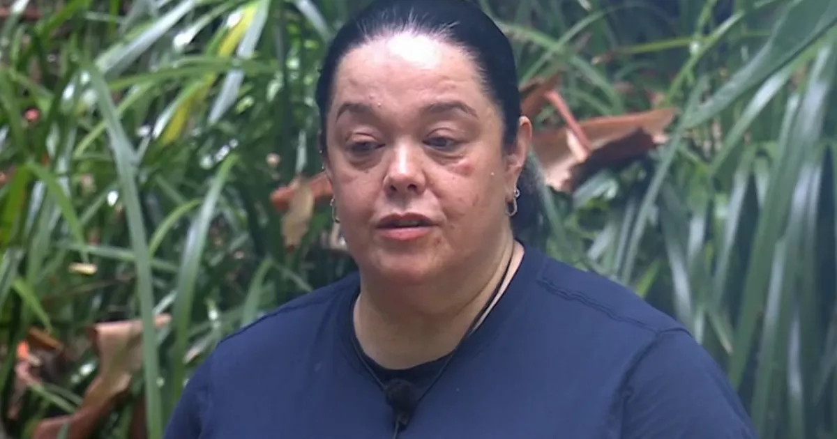 I'm A Celebrity's Lisa Riley sparks concern as ITV viewers ask 'what's wrong'