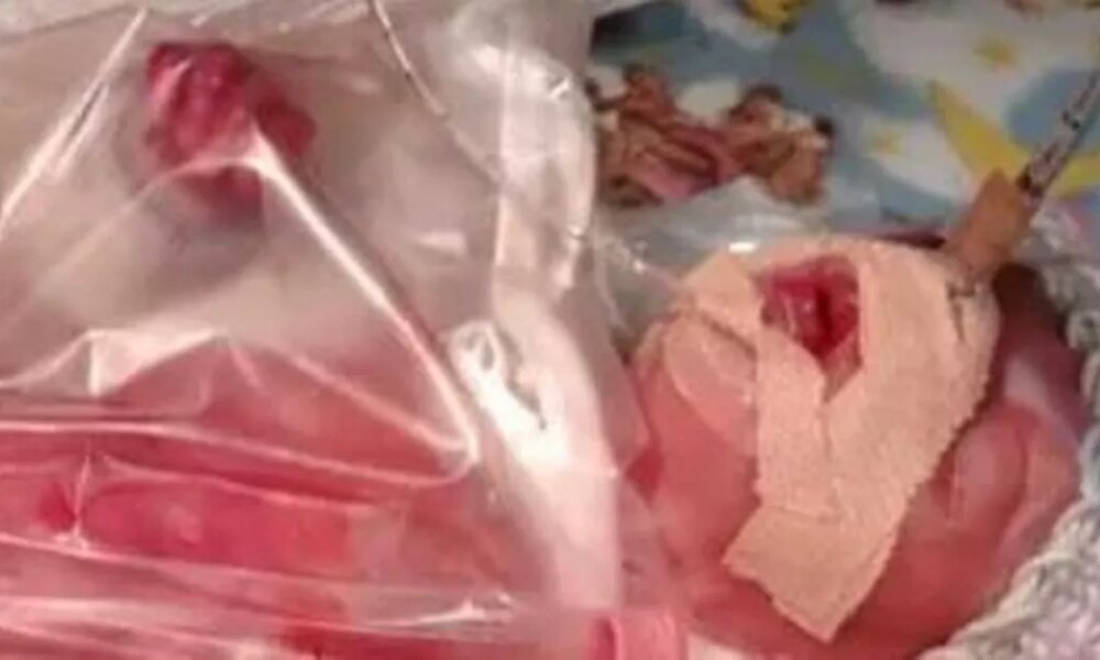 'It has been chaotic but you do the best you can': Supporting baby Cahir's fight