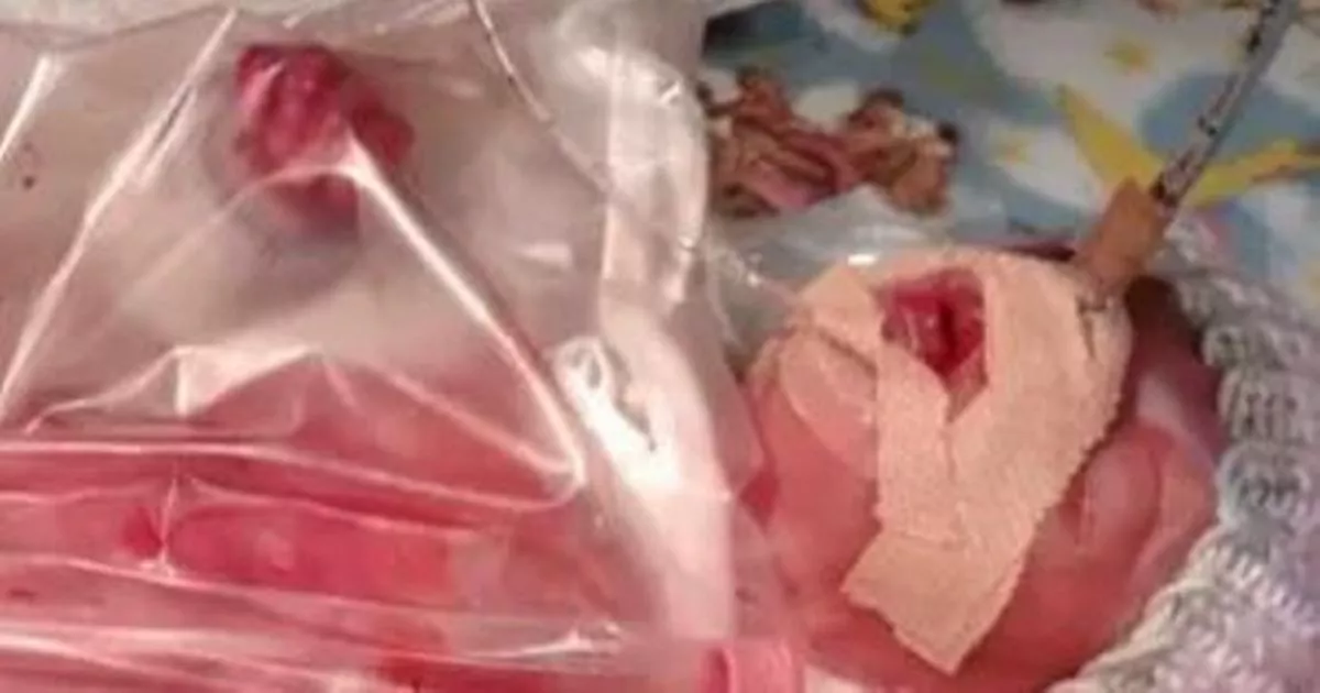 'It has been chaotic but you do the best you can': Supporting baby Cahir's fight