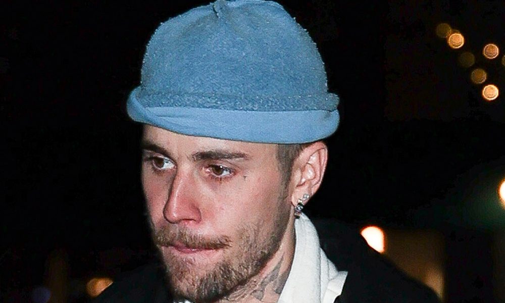 Justin Bieber Hurts Ribs in Electric Skateboard Fail