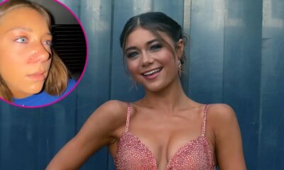 DWTS' Hailey Bills Has Possible Broken Nose After Thanksgiving Injury