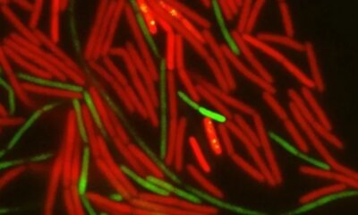 Hebrew University Study Reveals How Bacterial Motion Drives the Spread of Antibiotic Resistance