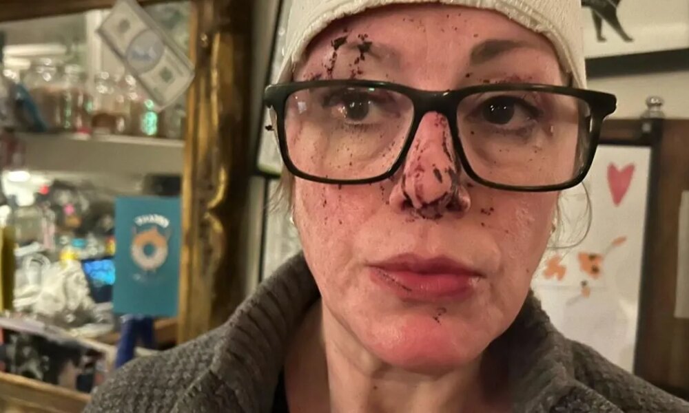 'I was nearly beaten to death after I refused a man a pint - then I almost had my pub taken away' | News UK